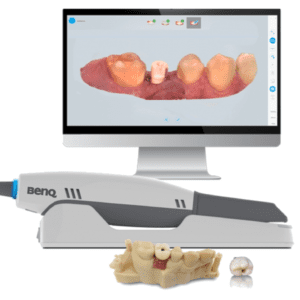 Máy scan BENQ BIS-1