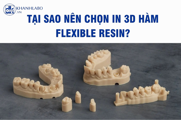 Lý do nên chọn in 3D hàm Flexible Resin