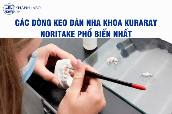 Các dòng keo dán nha khoa Kuraray Noritake
